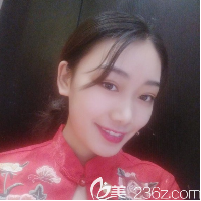 汕头华美双眼皮真人案例