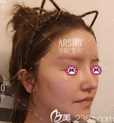 左日宜和陈敏院长给我做6D钻石<span style=