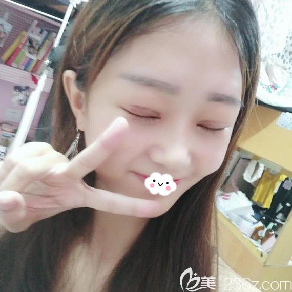 双眼皮术后疤痕恢复效果 双眼皮术后疤痕恢复效果