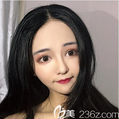 广州美恩陈宏彬做隆鼻怎么样 广州美恩陈宏彬做隆鼻怎么样