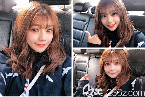 广州美恩陈宏彬做脂肪填充怎么样 广州美恩陈宏彬做脂肪填充怎么样