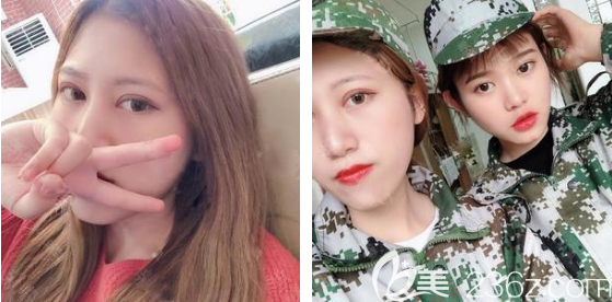 广州韩妃王媛做双眼皮怎么样 广州韩妃王媛做双眼皮怎么样