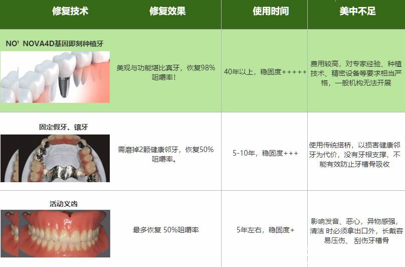 即可种植牙和固定假牙及活动义齿的区别