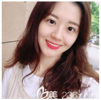 广州紫馨谷琪医生做双眼皮怎么样