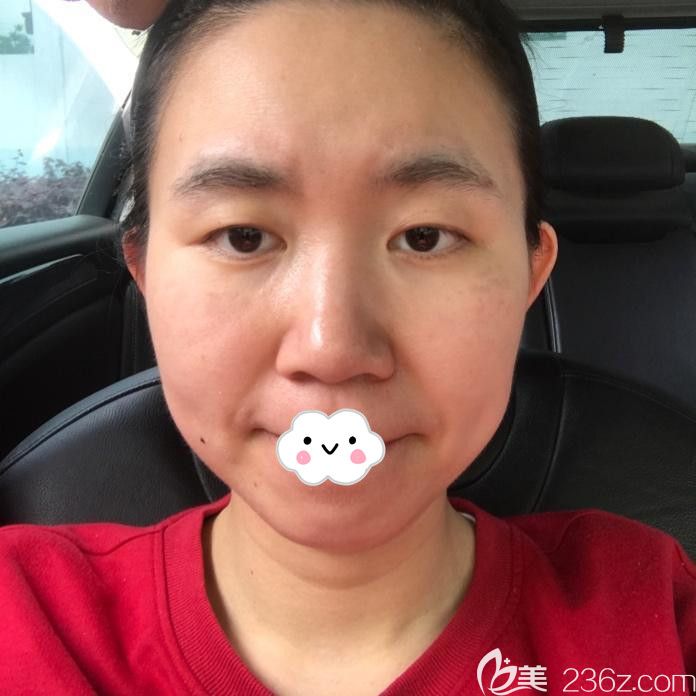 不知武汉哪个医院去斑好?找武汉五洲莱美