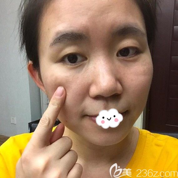 不知武汉哪个医院去斑好?找武汉五洲莱美