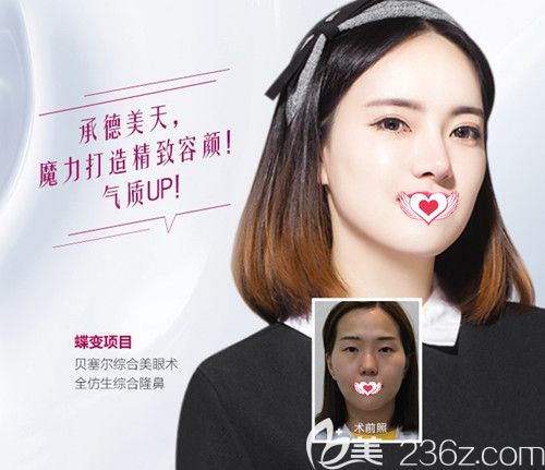 美天整形医院做鼻综合案例 美天整形医院做鼻综合案例