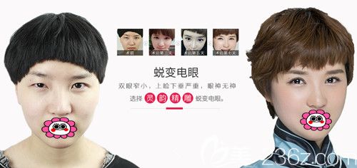 爱思特黄祥石双眼皮效果图