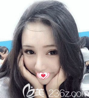 这次在邢台遇见美做的眼鼻综合手术 给我的感受就是整形前后对比效果反差挺大