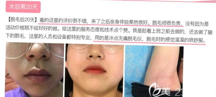 合肥哪家医院脱毛好?看合肥壹美尚脱毛后顾客口碑评价 合肥哪家医院脱毛好?看合肥壹美尚脱毛后顾客口碑评价