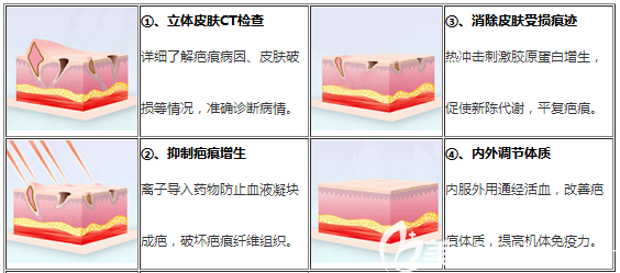 深圳鹏程医院疤痕科离子靶向多维综合祛疤体系 深圳鹏程医院疤痕科离子靶向多维综合祛疤体系