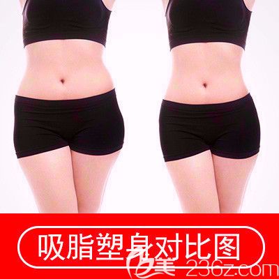 维多利亚吸脂整形案例 维多利亚吸脂整形案例