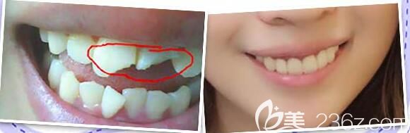 重庆牙博士口腔陈泽旭怎么样？案例效果验证医生实力