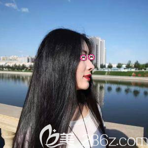 北京沃尔医疗美容诊所鼻修复<span style= 北京沃尔医疗美容诊所鼻修复<span style=