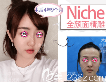 北京京韩整形医院价格表 面部脂肪填充单部位低至6240元，手臂吸脂低至17280元