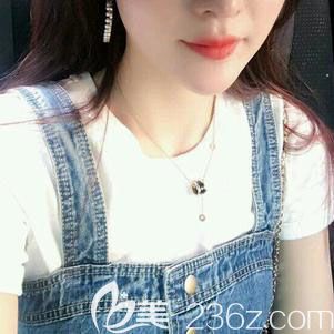 武汉涵美医疗美容袁羽假体隆胸案例 武汉涵美医疗美容袁羽假体隆胸案例