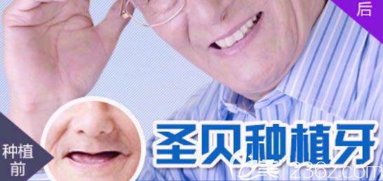 圣贝口腔陈可主任70岁老人全口种植牙前后对比照