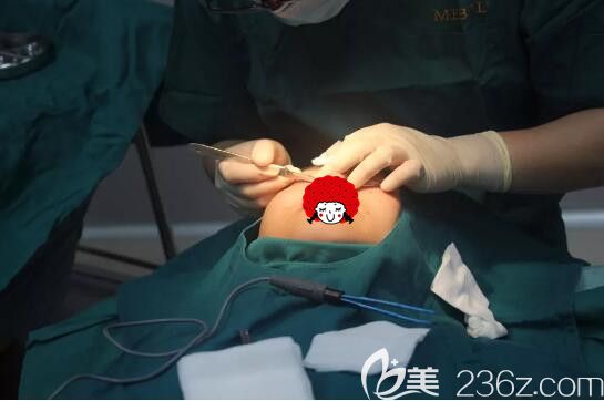 聂志宏医生做埋线法双眼皮+上睑下垂矫正的眼部整形手术中