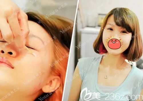 温州艺星注射<span style=