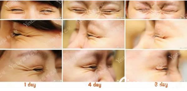 温州艺星注射<span style=