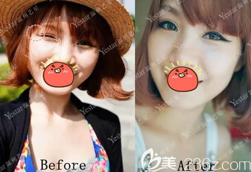 温州艺星注射<span style=