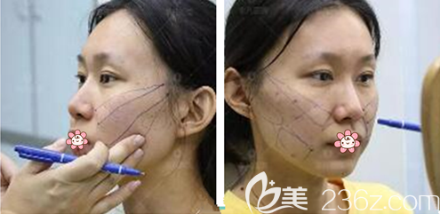 王志军院长给我画线