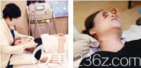 上海艺星医疗美容医院徐熠涵进口超声射频+蜂巢皮秒+真人案例术中照