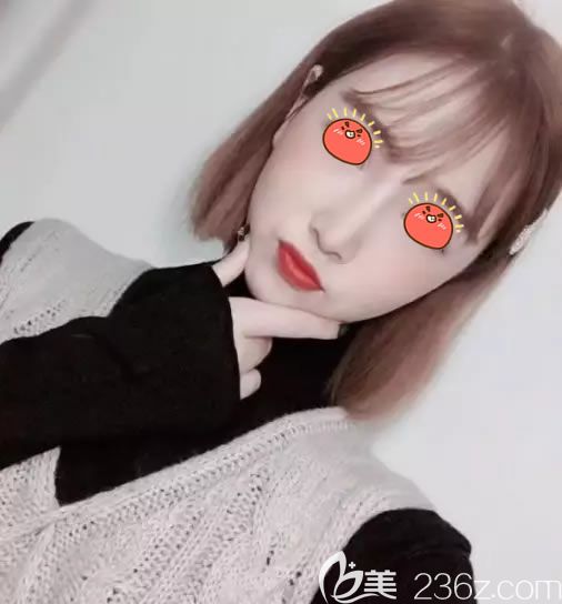 义乌阳光整形医院隆鼻隆下巴<span style=