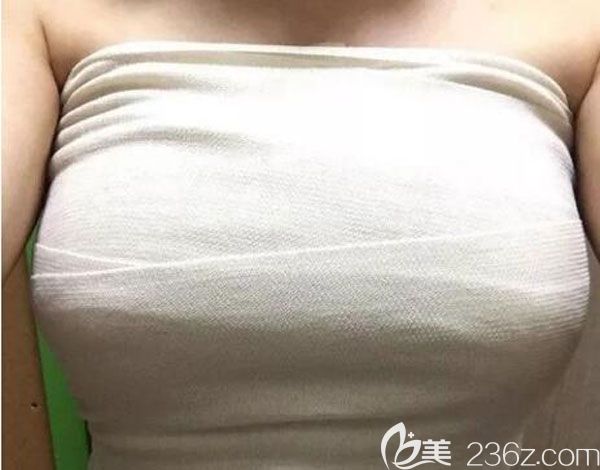 假体隆胸第8天胸部被裹着纱布 假体隆胸第8天胸部被裹着纱布