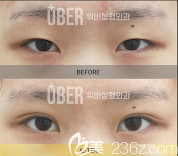 20190315_1552633221485759.png image.png