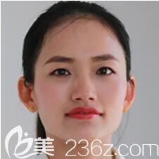 上海丽质医疗美容门诊部胡彩艳