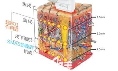 上海丽质医疗美容门诊部胡彩艳工作原理