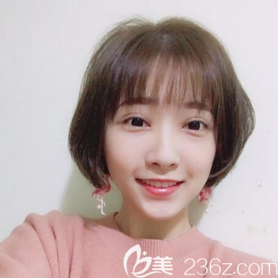 邓东伟切开双眼皮术后一个月恢复照 邓东伟切开双眼皮术后一个月恢复照