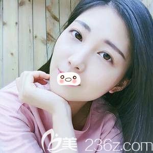 洛阳华美自体脂肪填充术后7i天 洛阳华美自体脂肪填充术后7i天