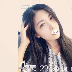 洛阳华美自体脂肪填充术后15天 洛阳华美自体脂肪填充术后15天