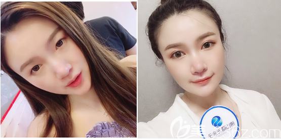 20190319_1552960220113872.png image.png