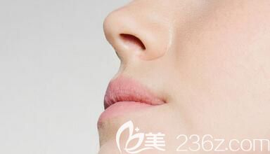 自体肋软骨隆鼻多久恢复? 自体肋软骨隆鼻多久恢复?