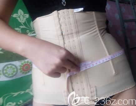 我在桂林美丽焦点做腰腹部环吸术后第7天 我在桂林美丽焦点做腰腹部环吸术后第7天