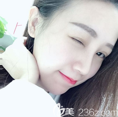 佛山曙光金子内部员工用亲身经历告诉你宋仁刚博士做肋软骨隆鼻子效果怎么样