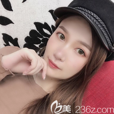 佛山曙光金子李淑薇做双眼皮怎么样 佛山曙光金子李淑薇做双眼皮怎么样