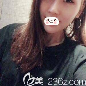 我的鼻综合手术日记-看洛阳爱尚李进雯帮我打造的高翘立挺小美鼻 