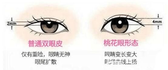 佳木斯韩艺来双眼皮优势