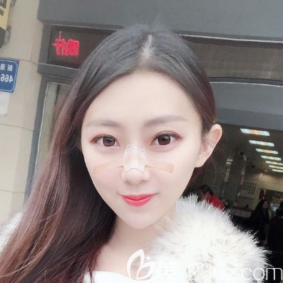 做完鼻综合隆鼻五天不能碰水