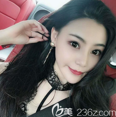 深圳丽港丽格谢俊隆鼻案例三个月反馈照片 深圳丽港丽格谢俊隆鼻案例三个月反馈照片