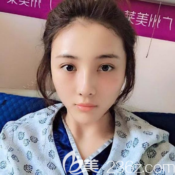 广州美莱<!--<i data=20240703-sp></i>-->自体脂肪全脸填充 广州美莱<!--<i data=20240703-sp></i>-->自体脂肪全脸填充