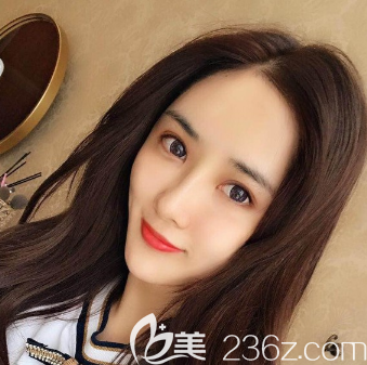 <!--<i data=20240703-sp></i>-->面部脂肪填充全脸一个月恢复自然 <!--<i data=20240703-sp></i>-->面部脂肪填充全脸一个月恢复自然