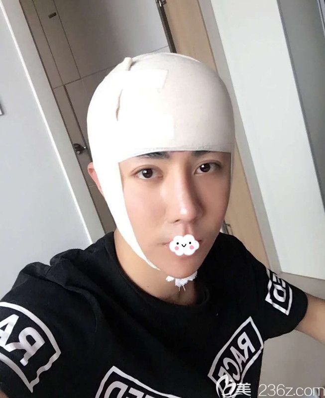 不想做植发到韩国凯伦秀做额头缩小术后即刻照片 不想做植发到韩国凯伦秀做额头缩小术后即刻照片