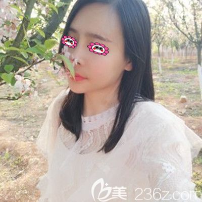 术后一个月效果展示图