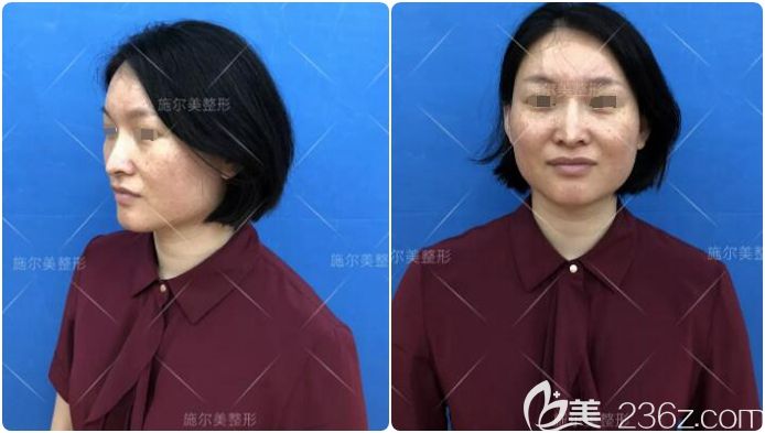 面诊无锡施尔美术前面部明显的皮肤问题 面诊无锡施尔美术前面部明显的皮肤问题