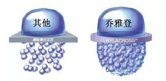 乔雅登玻尿酸分子量比较大，比较硬以及粘弹性比较高